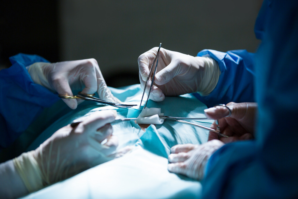 Equipe médica realizando cirurgia de prostata radical em centro cirúrgico
